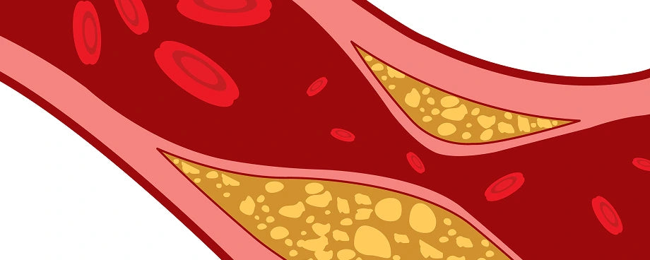 Cholesterol illustration